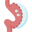 bariatric surgery