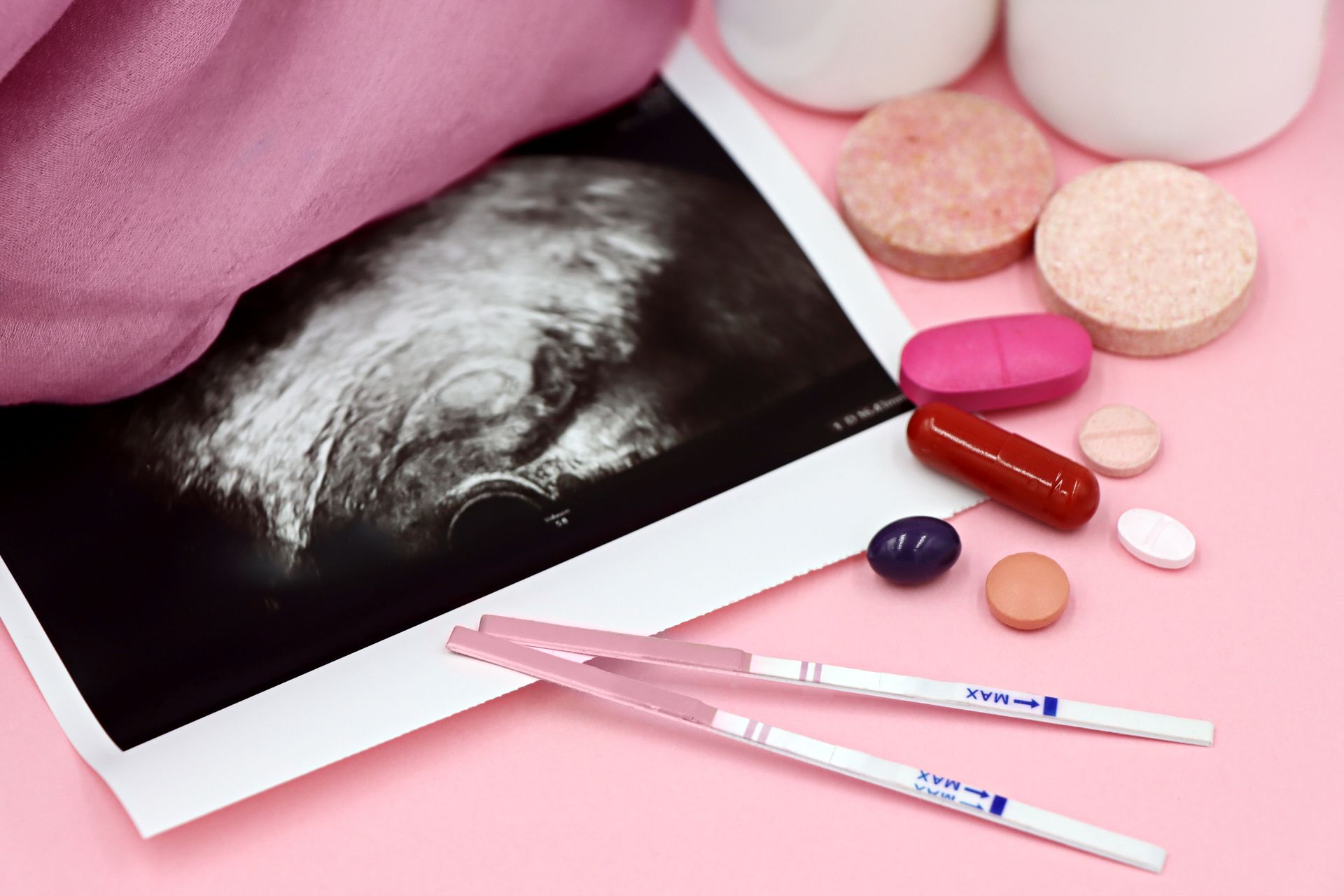 IVF1